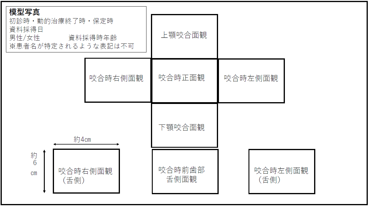 PDFの場合